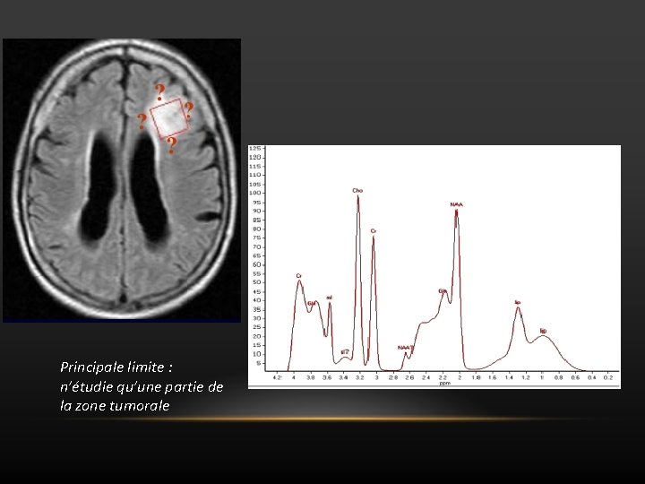 Principale limite : n’étudie qu’une partie de la zone tumorale 