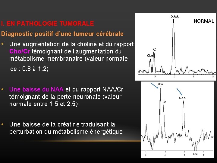 I. EN PATHOLOGIE TUMORALE Diagnostic positif d’une tumeur cérébrale • Une augmentation de la