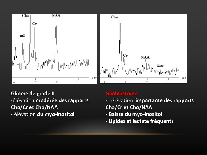 Gliome de grade II -élévation modérée des rapports Cho/Cr et Cho/NAA - élévation du