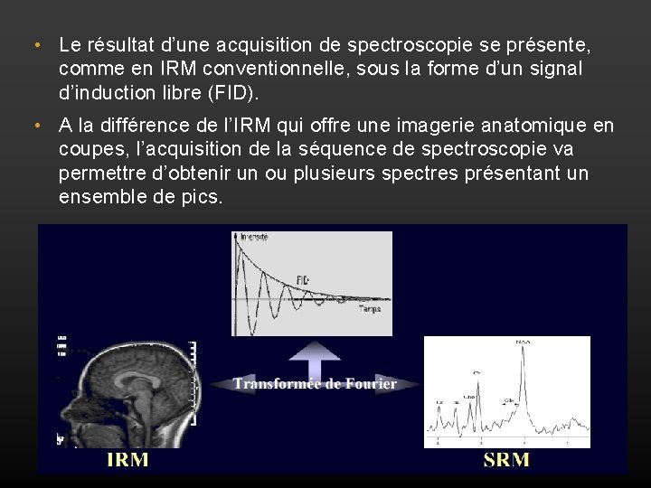  • Le résultat d’une acquisition de spectroscopie se présente, comme en IRM conventionnelle,