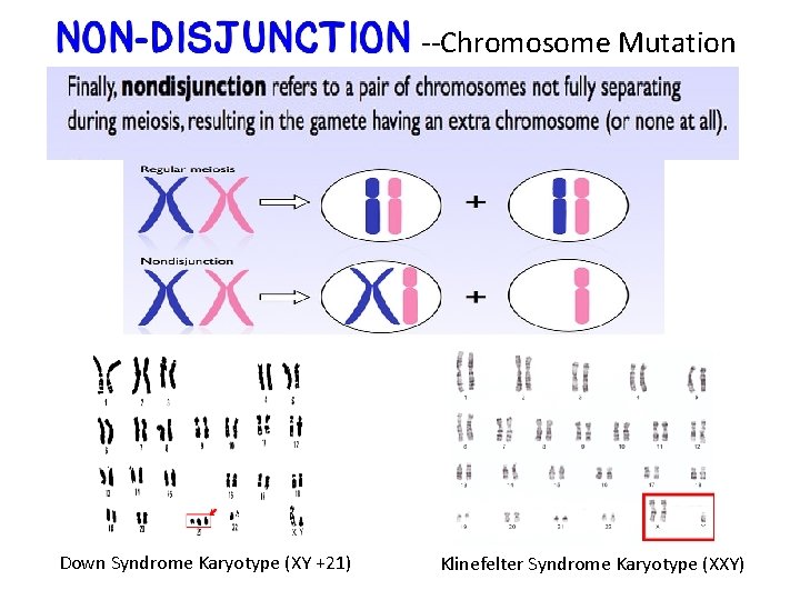 --Chromosome Mutation Down Syndrome Karyotype (XY +21) Klinefelter Syndrome Karyotype (XXY) 