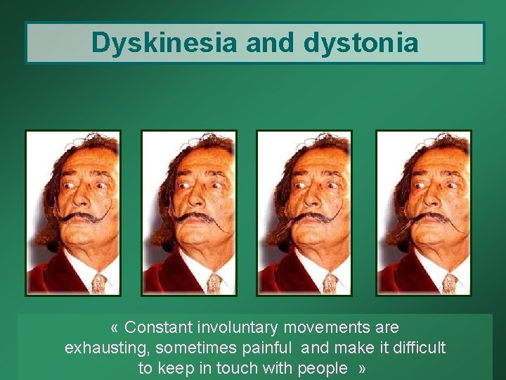 Dyskinesia and dystonia « Constant involuntary movements are exhausting, sometimes painful and make it