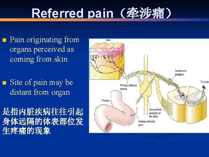 Referred pain（牵涉痛） n Pain originating from organs perceived as coming from skin n Site