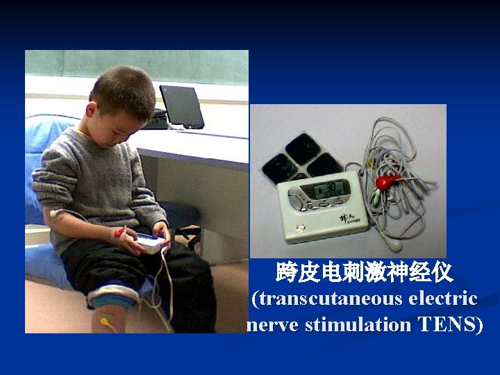 跨皮电刺激神经仪 (transcutaneous electric nerve stimulation TENS) 