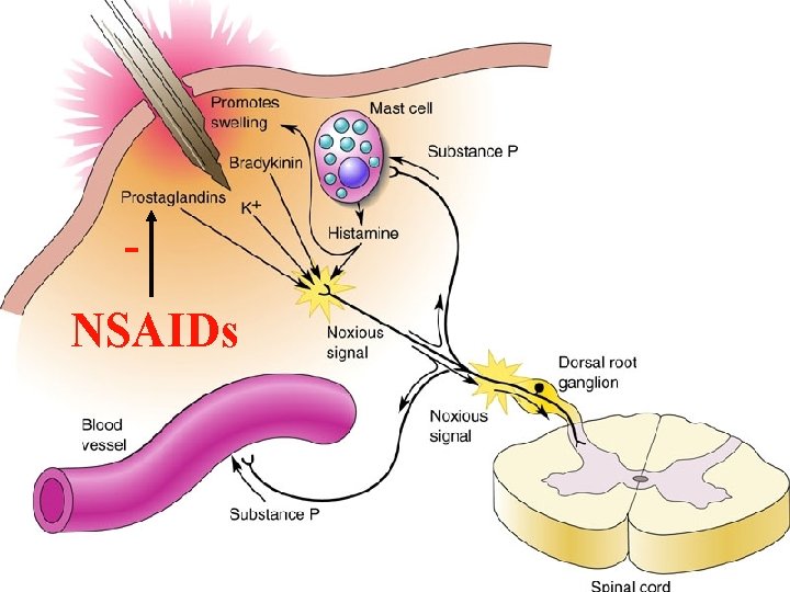 NSAIDs 