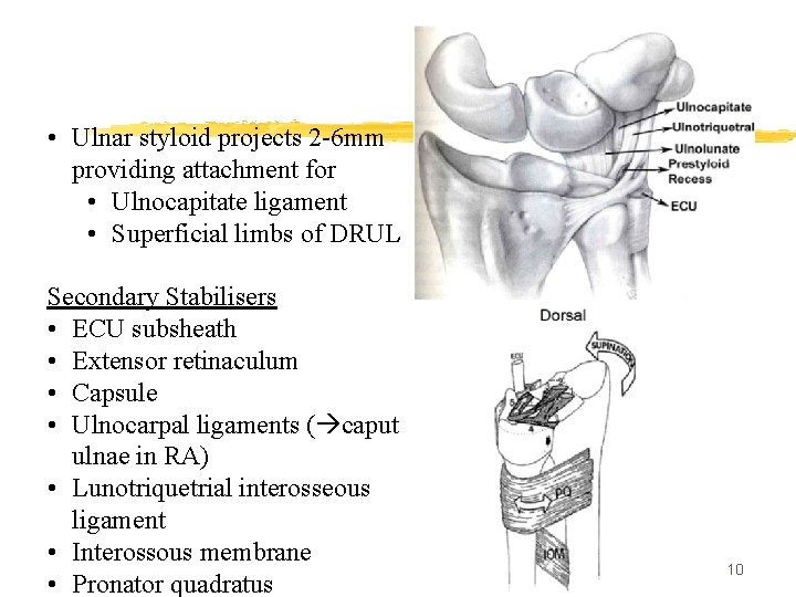  • Ulnar styloid projects 2 -6 mm providing attachment for • Ulnocapitate ligament