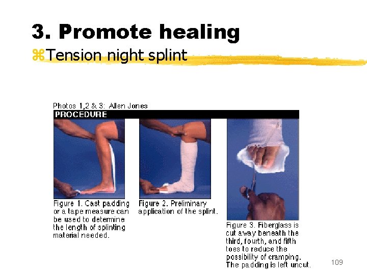 3. Promote healing z. Tension night splint 109 