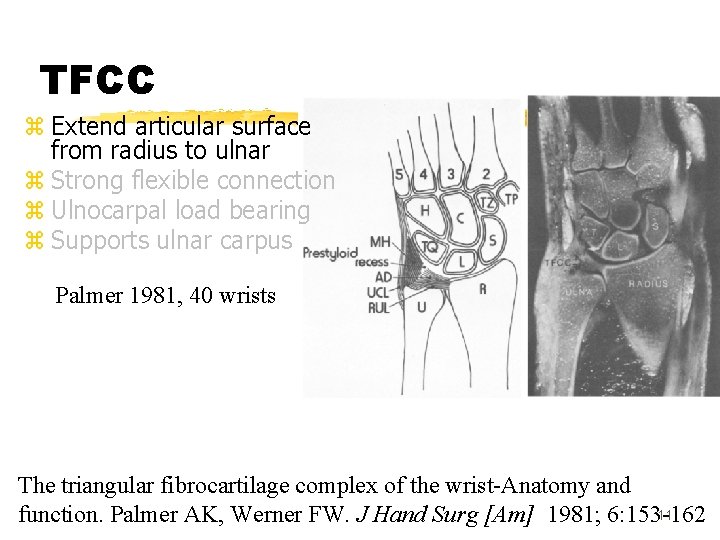 TFCC z Extend articular surface from radius to ulnar z Strong flexible connection z