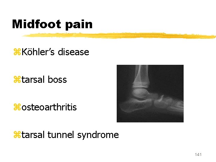 Midfoot pain z. Köhler’s disease ztarsal boss zosteoarthritis ztarsal tunnel syndrome 141 