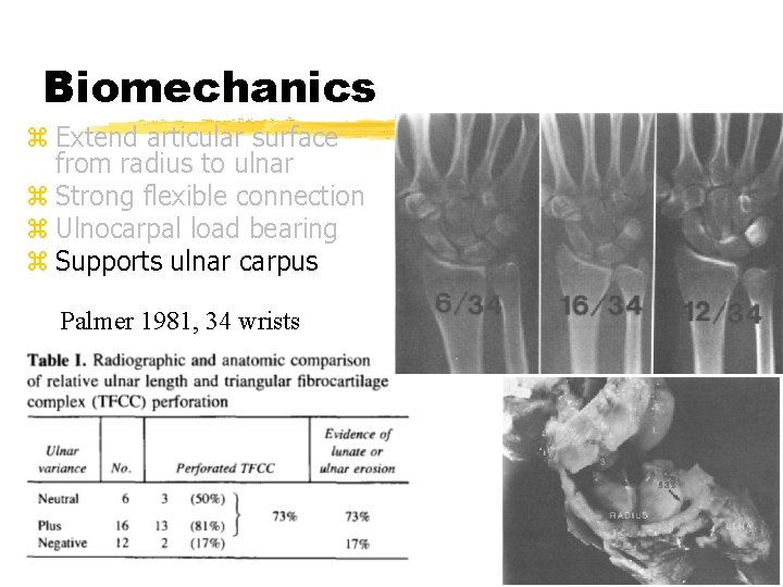 Biomechanics z Extend articular surface from radius to ulnar z Strong flexible connection z