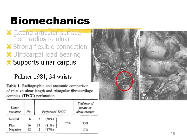 Biomechanics z Extend articular surface from radius to ulnar z Strong flexible connection z