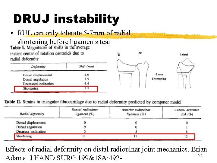 DRUJ instability • RUL can only tolerate 5 -7 mm of radial shortening before