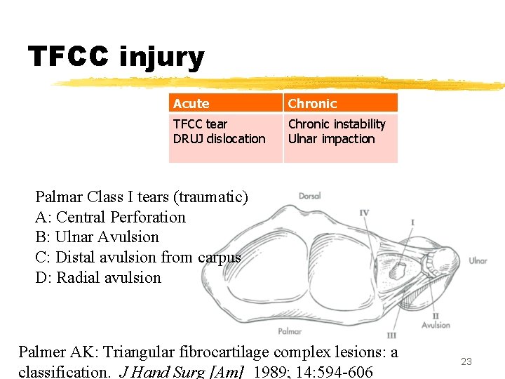 TFCC injury Acute Chronic TFCC tear DRUJ dislocation Chronic instability Ulnar impaction Palmar Class