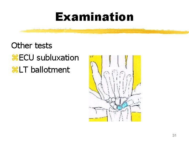 Examination Other tests z. ECU subluxation z. LT ballotment 31 