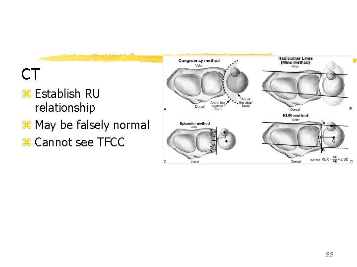 CT z Establish RU relationship z May be falsely normal z Cannot see TFCC