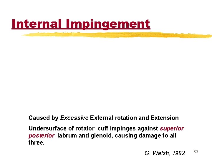Internal Impingement Caused by Excessive External rotation and Extension Undersurface of rotator cuff impinges