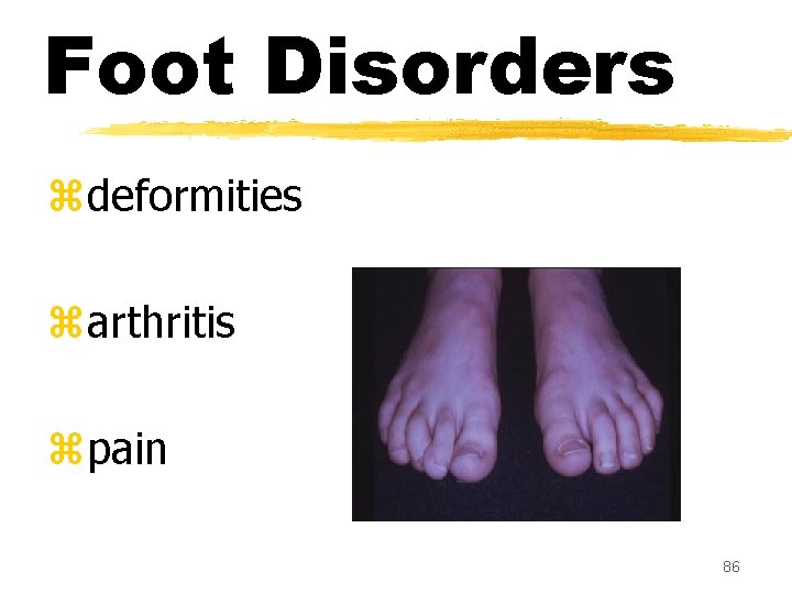 Foot Disorders zdeformities zarthritis zpain 86 