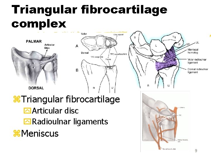 Triangular fibrocartilage complex z. Triangular fibrocartilage y. Articular disc y. Radioulnar ligaments z. Meniscus