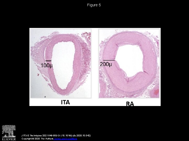 The radial artery An important component of multiarterial