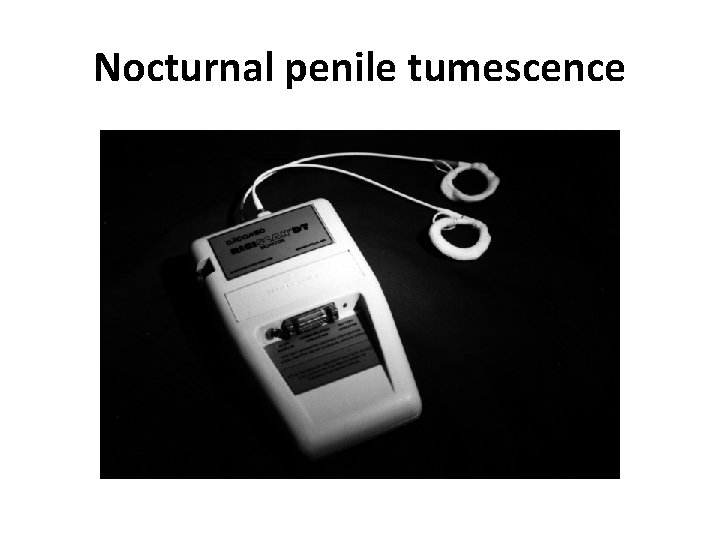 Nocturnal penile tumescence Nocturnal penile tumescence