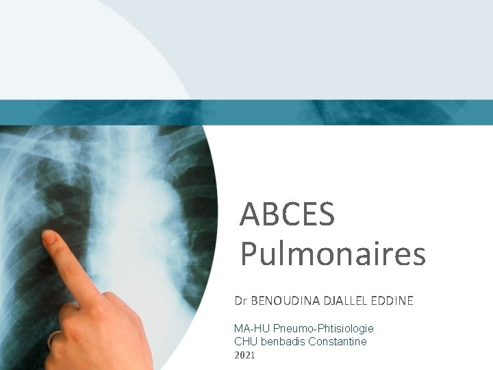 ABCES Pulmonaires Dr BENOUDINA DJALLEL EDDINE MA-HU Pneumo-Phtisiologie CHU benbadis Constantine 2021 