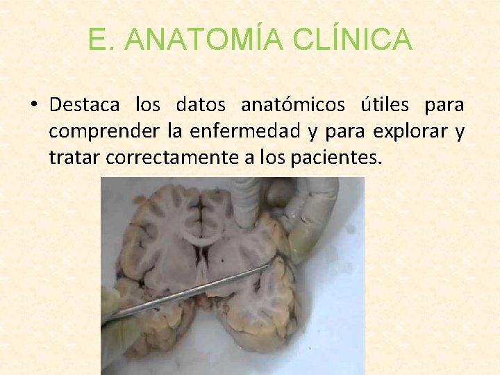 E. ANATOMÍA CLÍNICA • Destaca los datos anatómicos útiles para comprender la enfermedad y