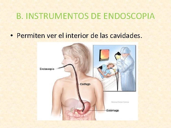 B. INSTRUMENTOS DE ENDOSCOPIA • Permiten ver el interior de las cavidades. 