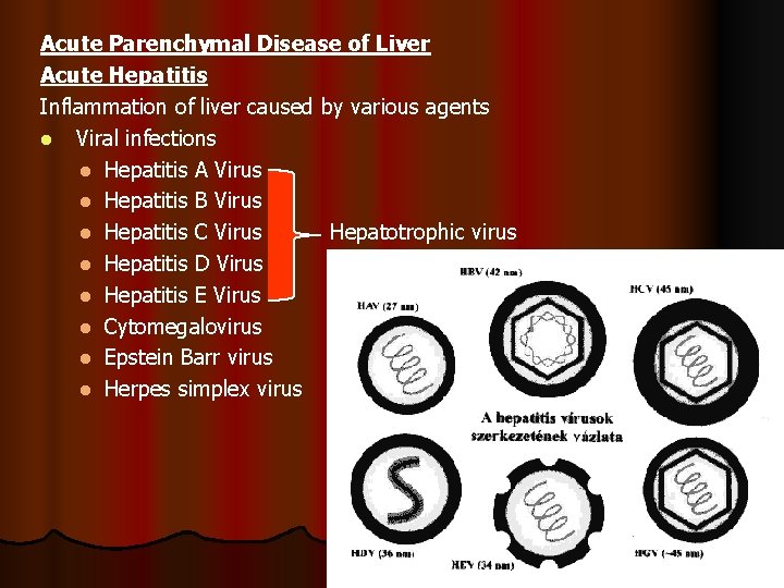 Acute Parenchymal Disease of Liver Acute Hepatitis Inflammation of liver caused by various agents