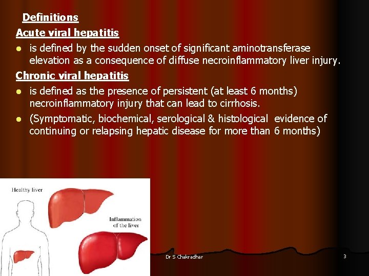 Definitions Acute viral hepatitis is defined by the sudden onset of significant aminotransferase elevation