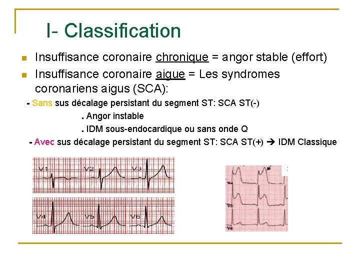 I- Classification n n Insuffisance coronaire chronique = angor stable (effort) Insuffisance coronaire aigue