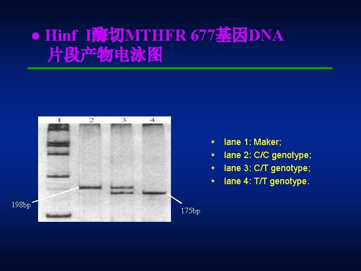 ● Hinf I酶切MTHFR 677基因DNA 片段产物电泳图 lane 1: Maker; w lane 2: C/C genotype; w
