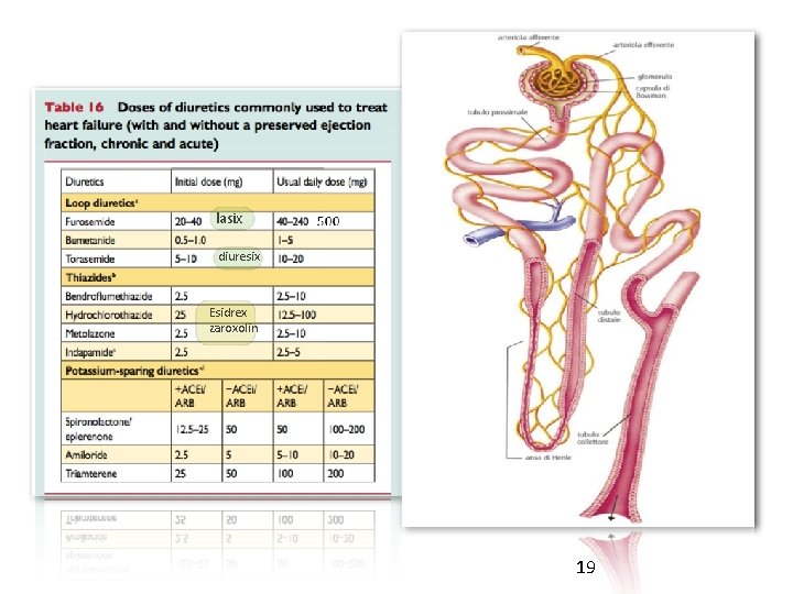 lasix diuresix Esidrex zaroxolin 19 