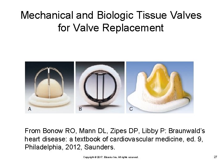 Mechanical and Biologic Tissue Valves for Valve Replacement From Bonow RO, Mann DL, Zipes