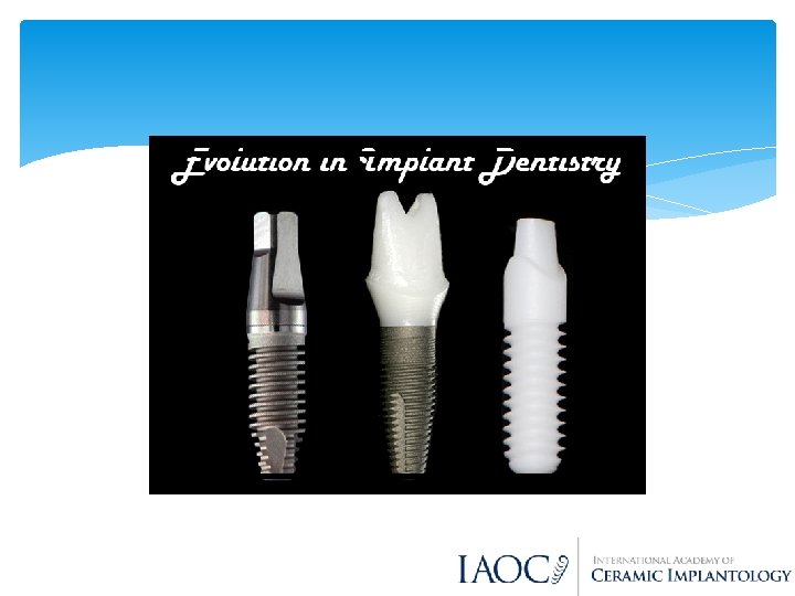 An analysis of Dental Implant Materials with an