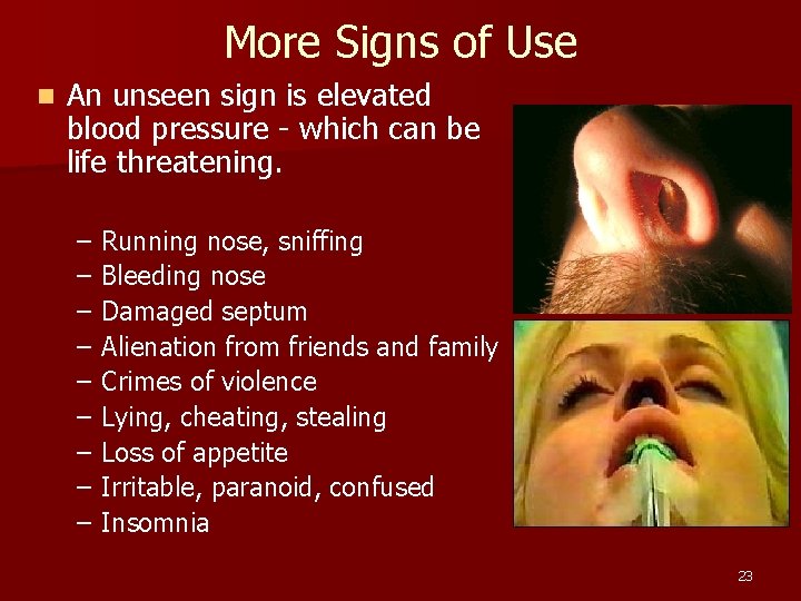 More Signs of Use n An unseen sign is elevated blood pressure - which