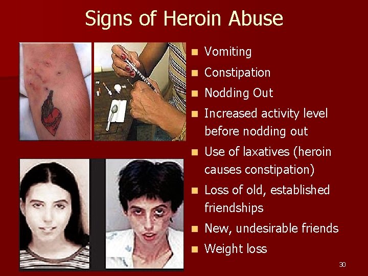 Signs of Heroin Abuse n Vomiting n Constipation n Nodding Out n Increased activity