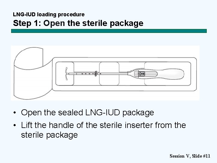 LNG-IUD loading procedure Step 1: Open the sterile package • Open the sealed LNG-IUD
