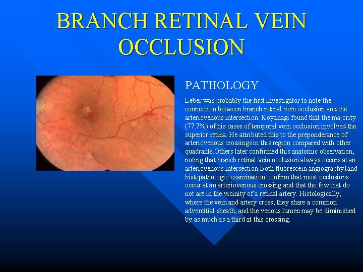 Retinal Vein Occlusions Morphology Crvo N Brvo N