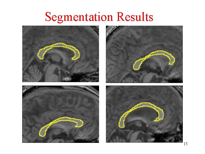 Segmentation Results 15 