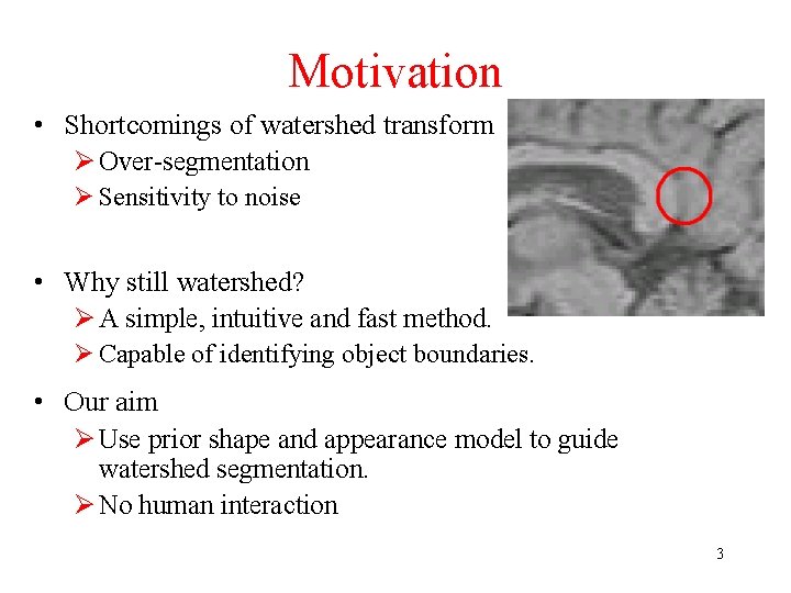 Motivation • Shortcomings of watershed transform Ø Over-segmentation Ø Sensitivity to noise • Why