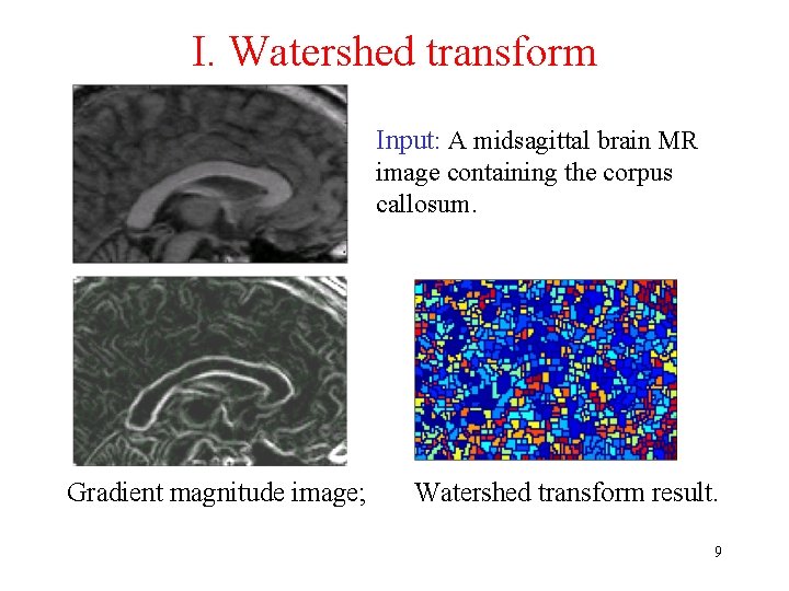 I. Watershed transform Input: A midsagittal brain MR image containing the corpus callosum. Gradient