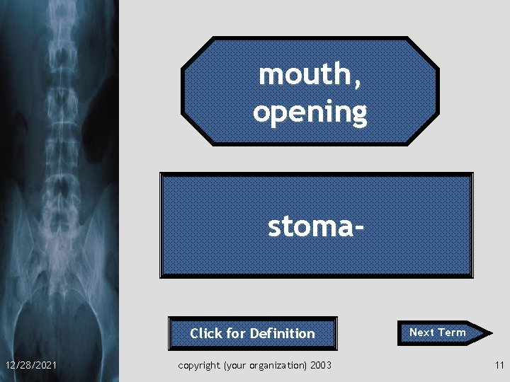 mouth, opening stoma- Click for Definition 12/28/2021 copyright (your organization) 2003 Next Term 11