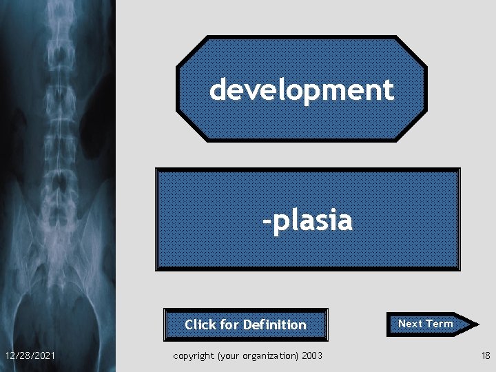 development -plasia Click for Definition 12/28/2021 copyright (your organization) 2003 Next Term 18 