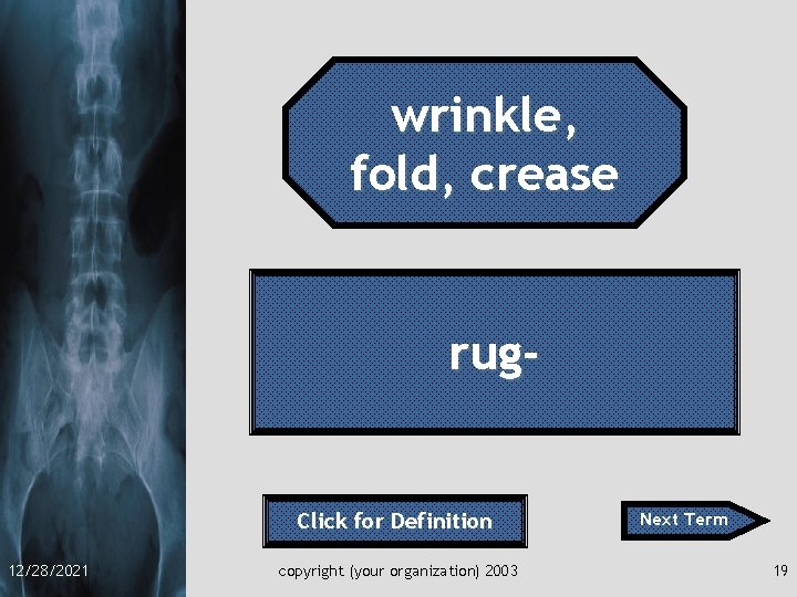 wrinkle, fold, crease rug- Click for Definition 12/28/2021 copyright (your organization) 2003 Next Term
