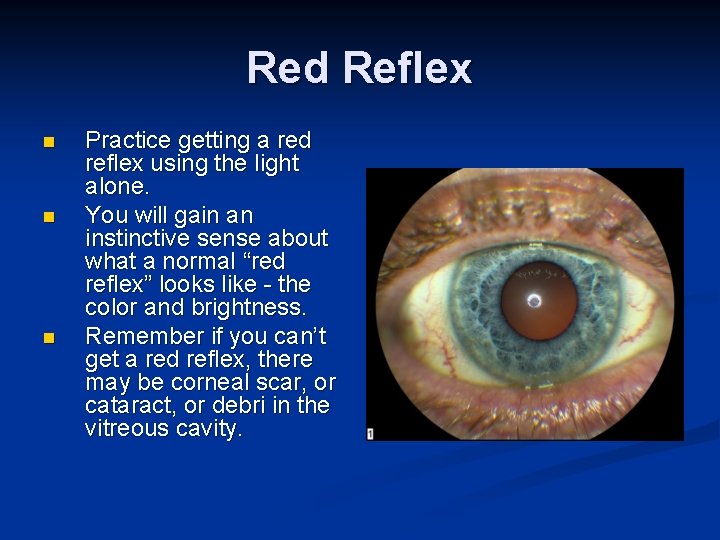 Red Reflex n n n Practice getting a red reflex using the light alone.