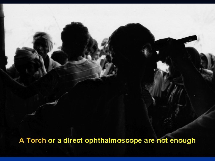A Torch or a direct ophthalmoscope are not enough 