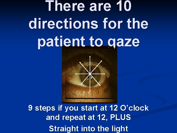 There are 10 directions for the patient to gaze 9 steps if you start