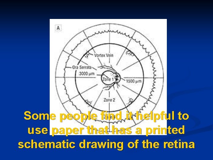 Some people find it helpful to use paper that has a printed schematic drawing