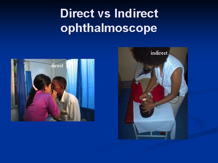 Direct vs Indirect ophthalmoscope indirect 