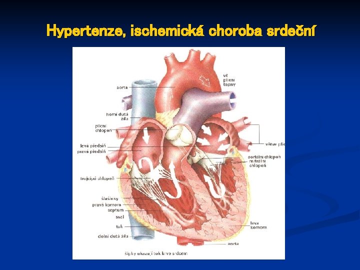 Hypertenze, ischemická choroba srdeční 